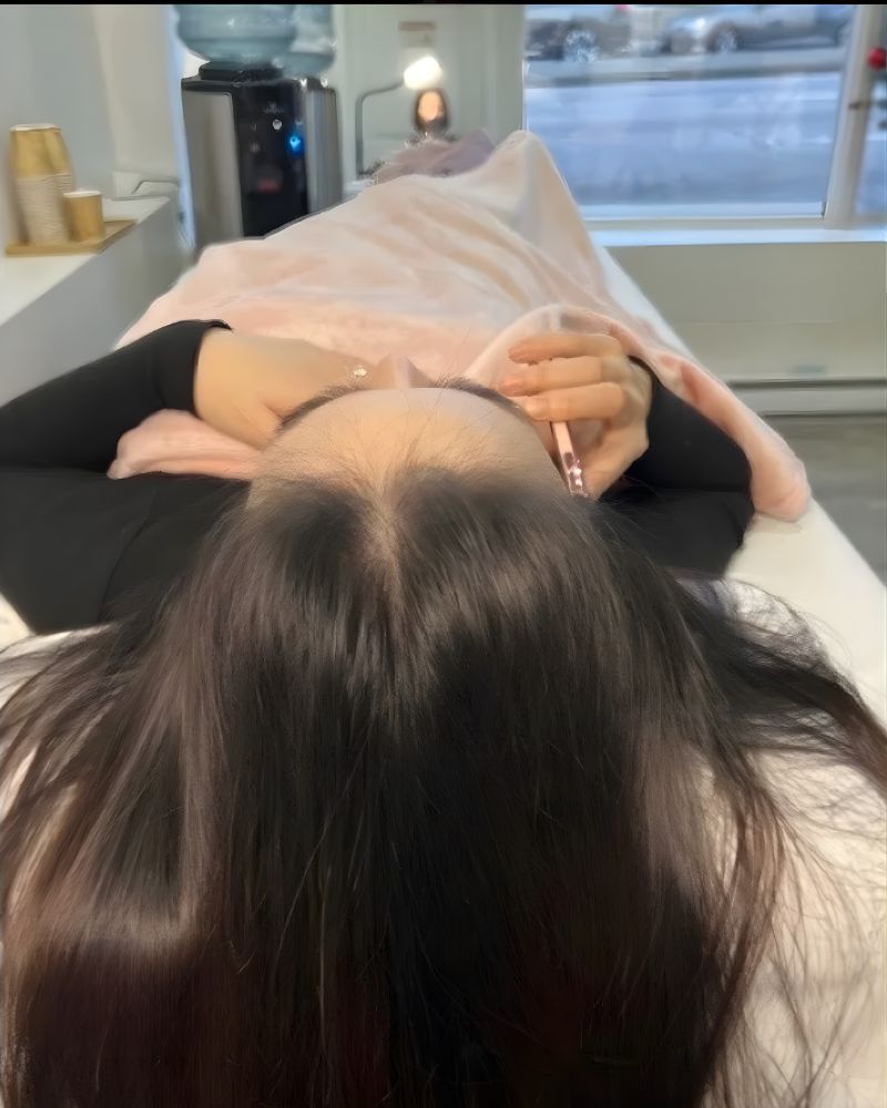 After Phục hồi tóc bằng Biotin