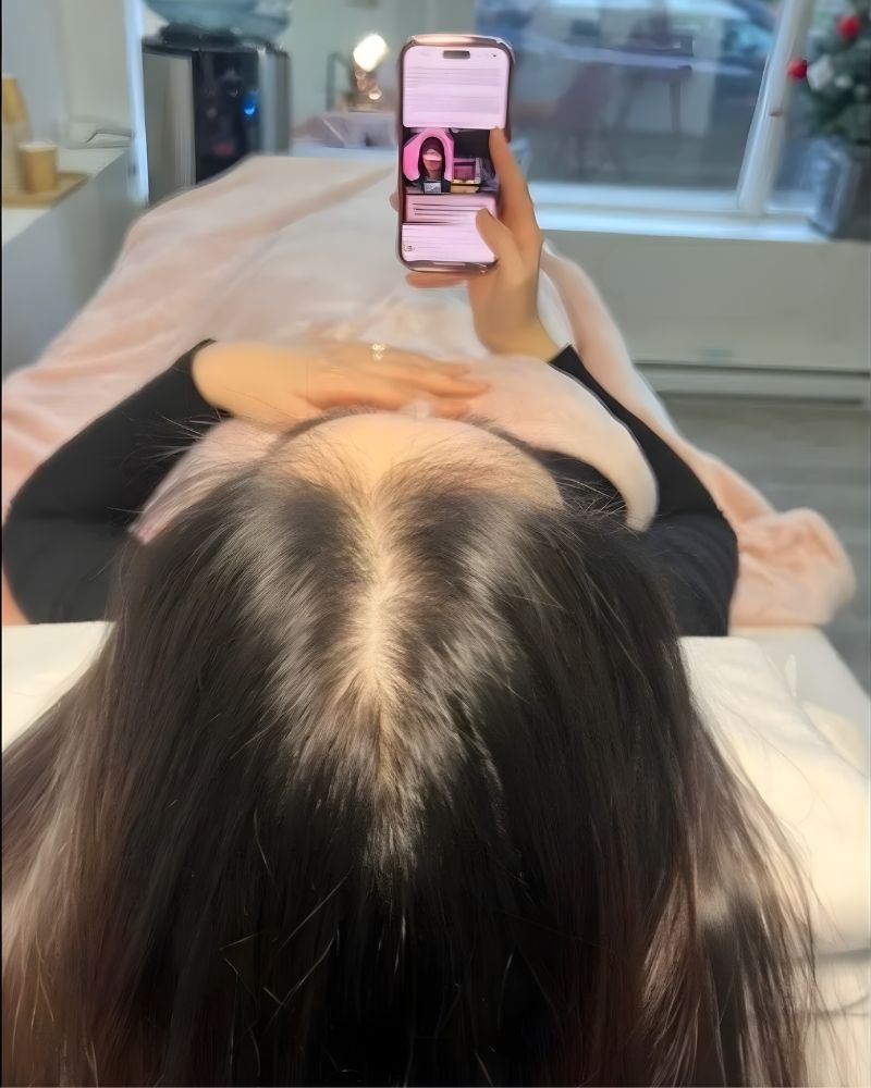 Before Phục hồi tóc bằng Biotin